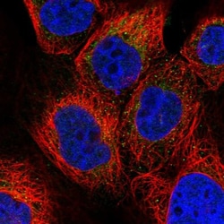 PET112L Antibody, Novus Biologicals:Antibodies:Primary Antibodies